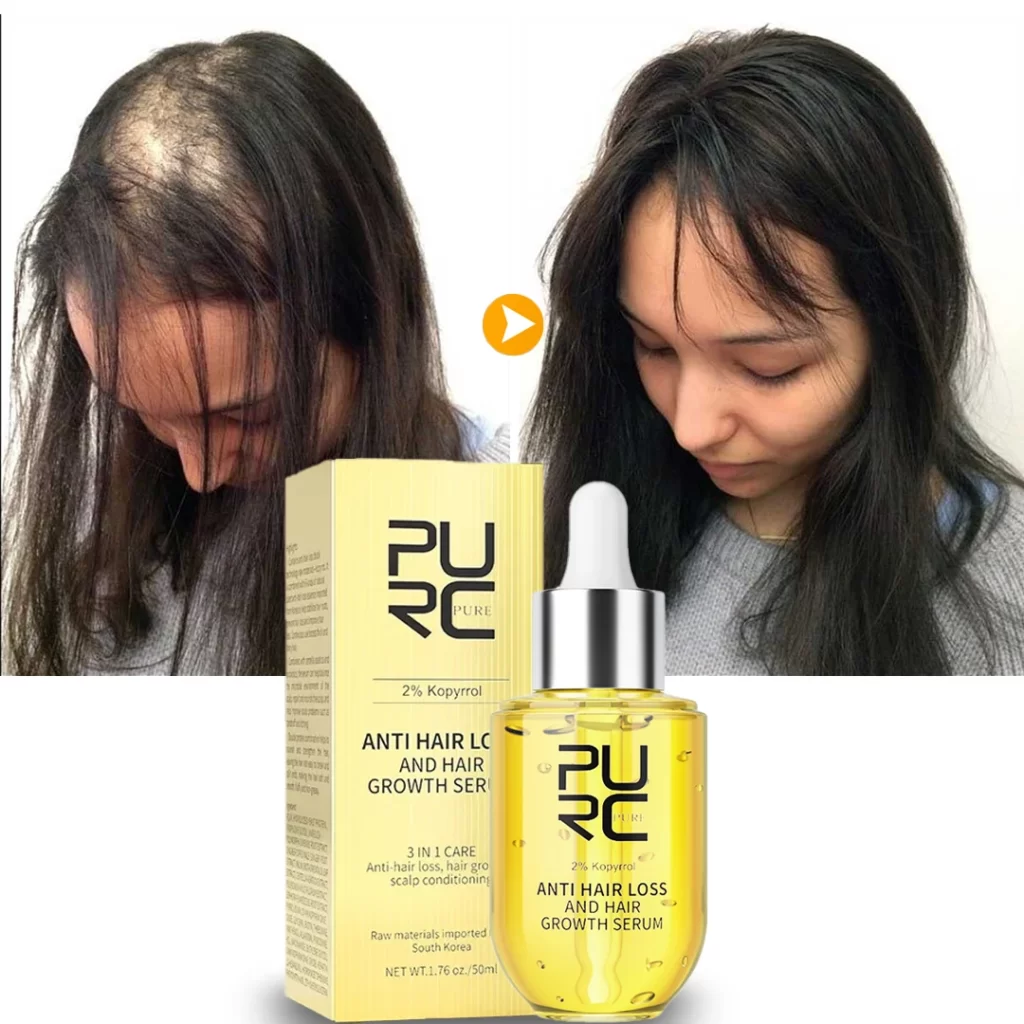 Biotine Pour Cheveux