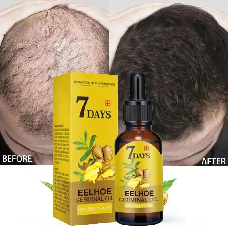 Shampoing Pousse De Cheveux