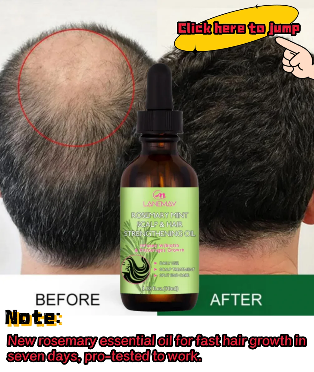 Sérum de croissance des cheveux au gingembre