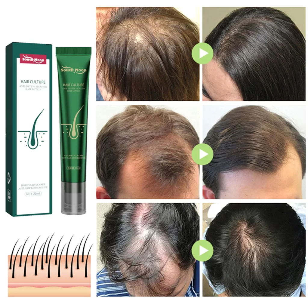 Produit Naturel Pour Faire Pousser Les Cheveux