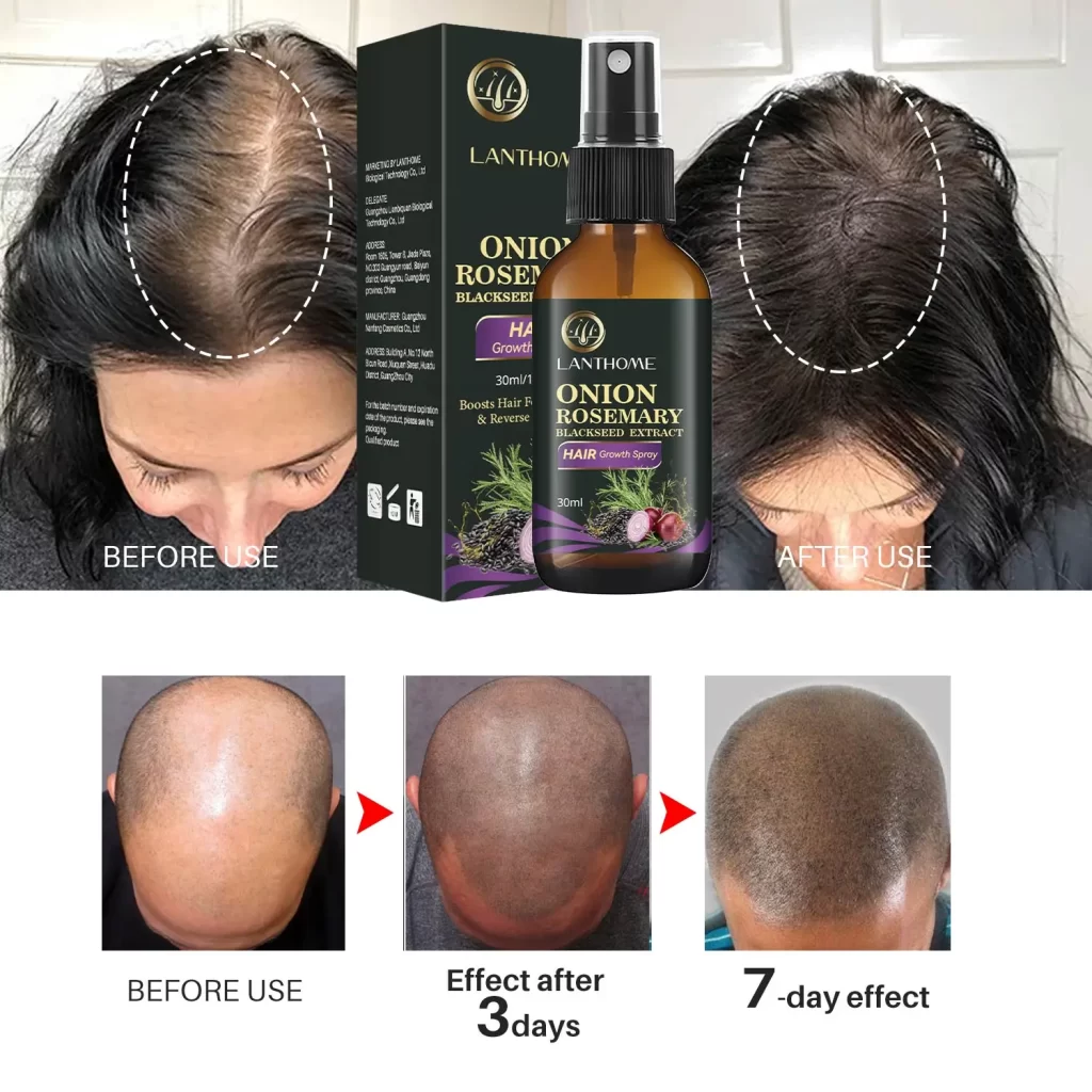 Shampoing Pousse De Cheveux