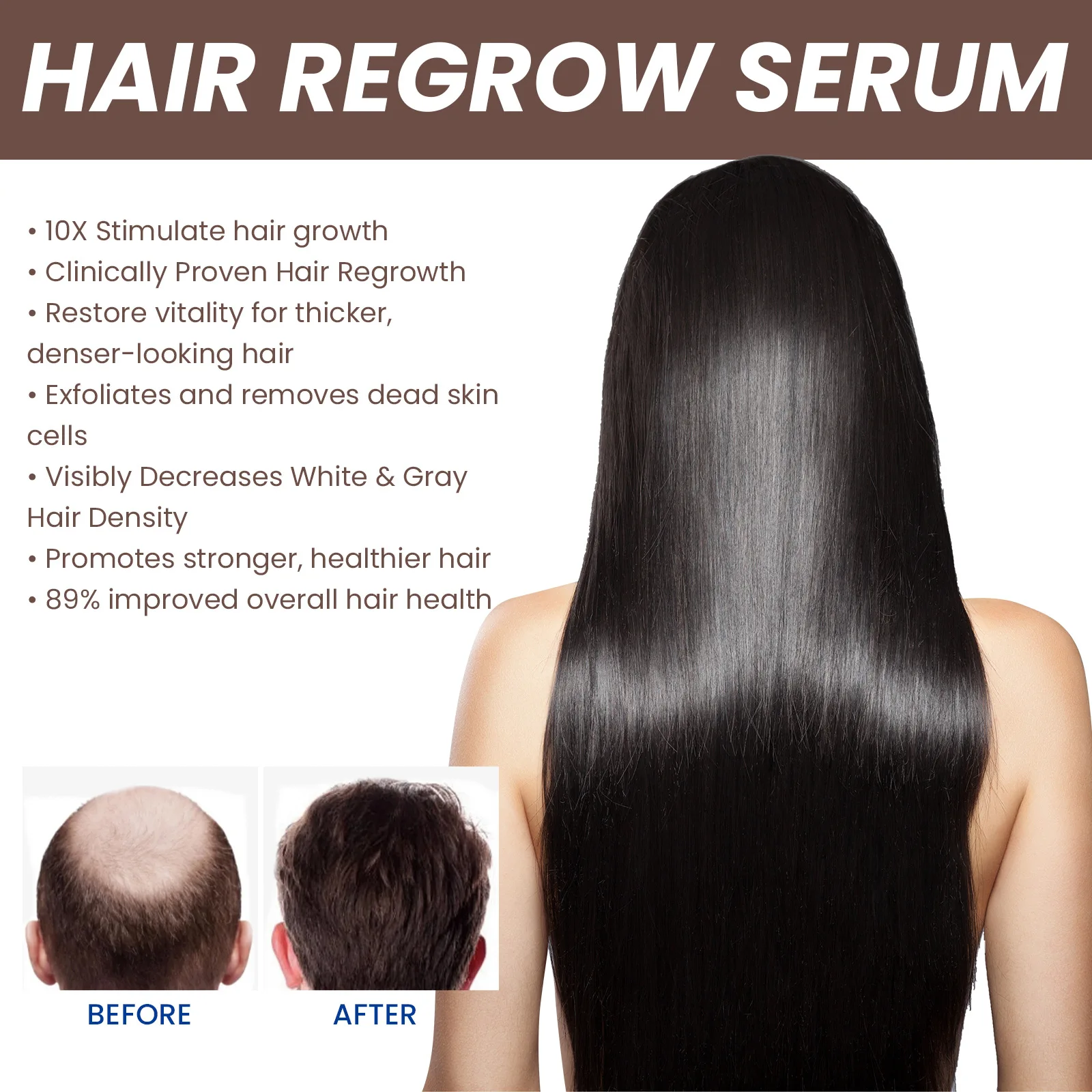 Huile essentielle anti-perte pour la croissance des cheveux