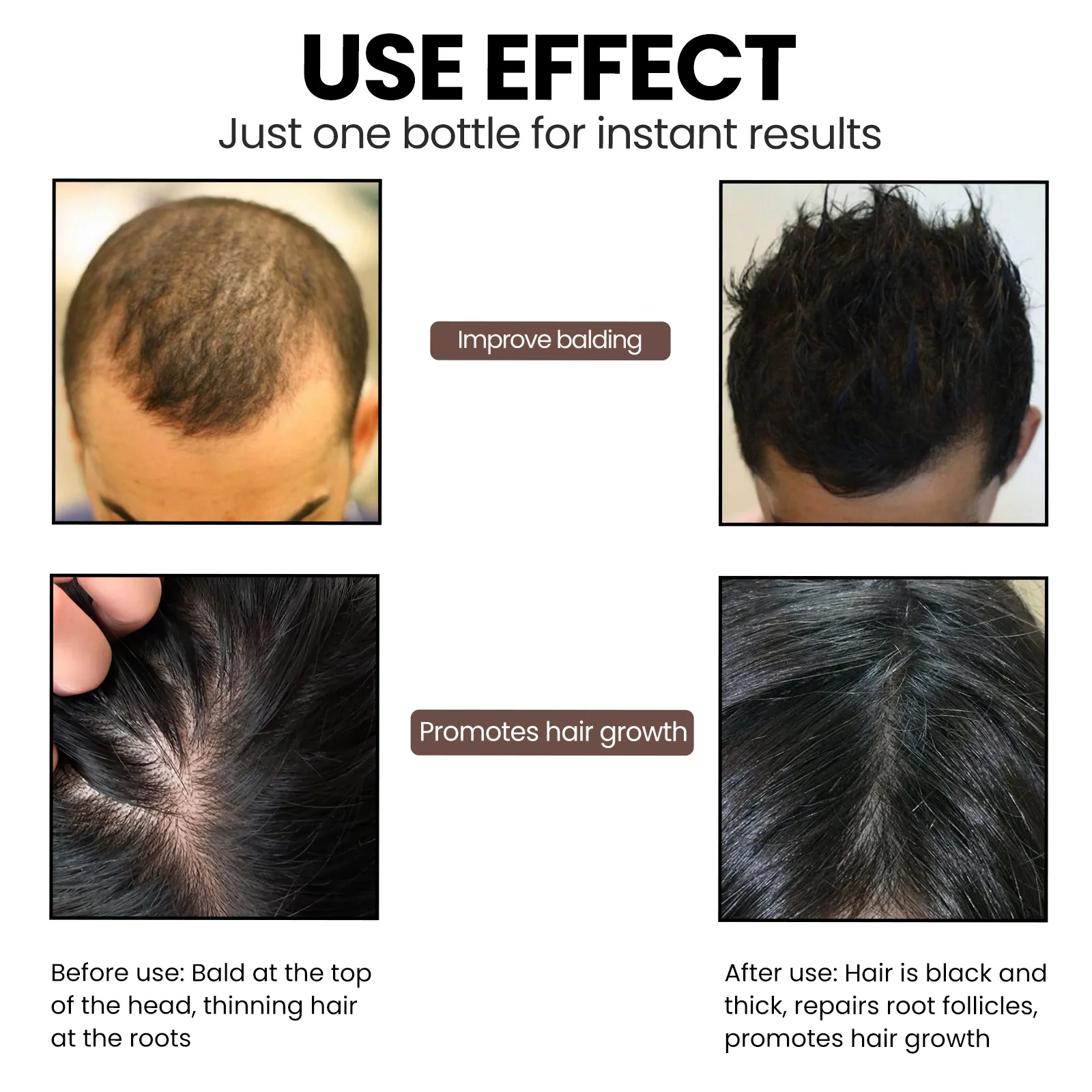 Huile essentielle anti-perte pour la croissance des cheveux