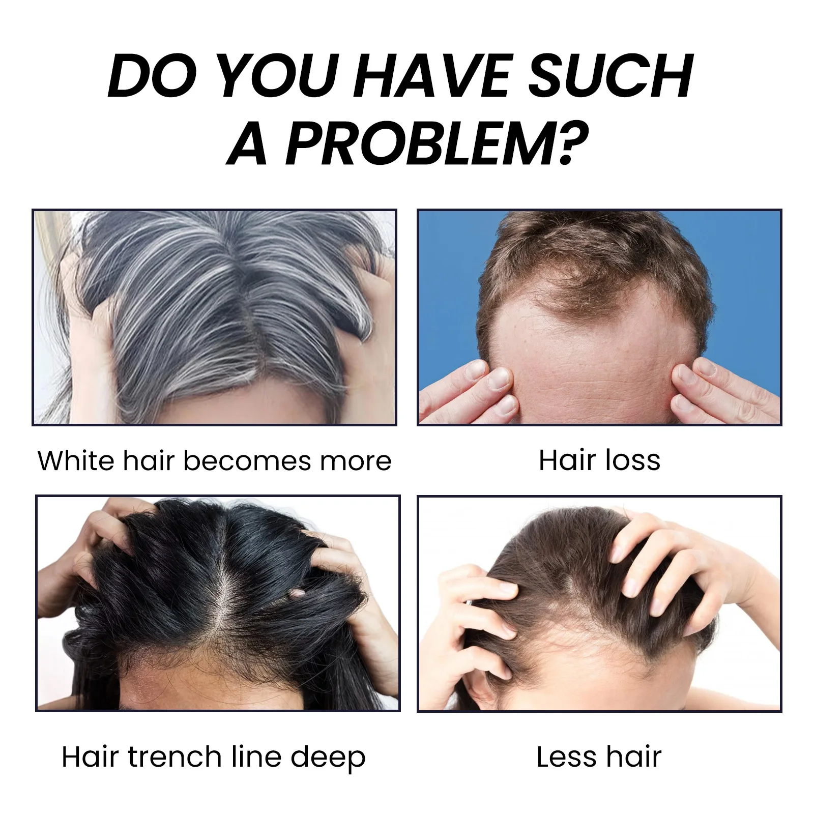 Huile essentielle anti-perte pour la croissance des cheveux