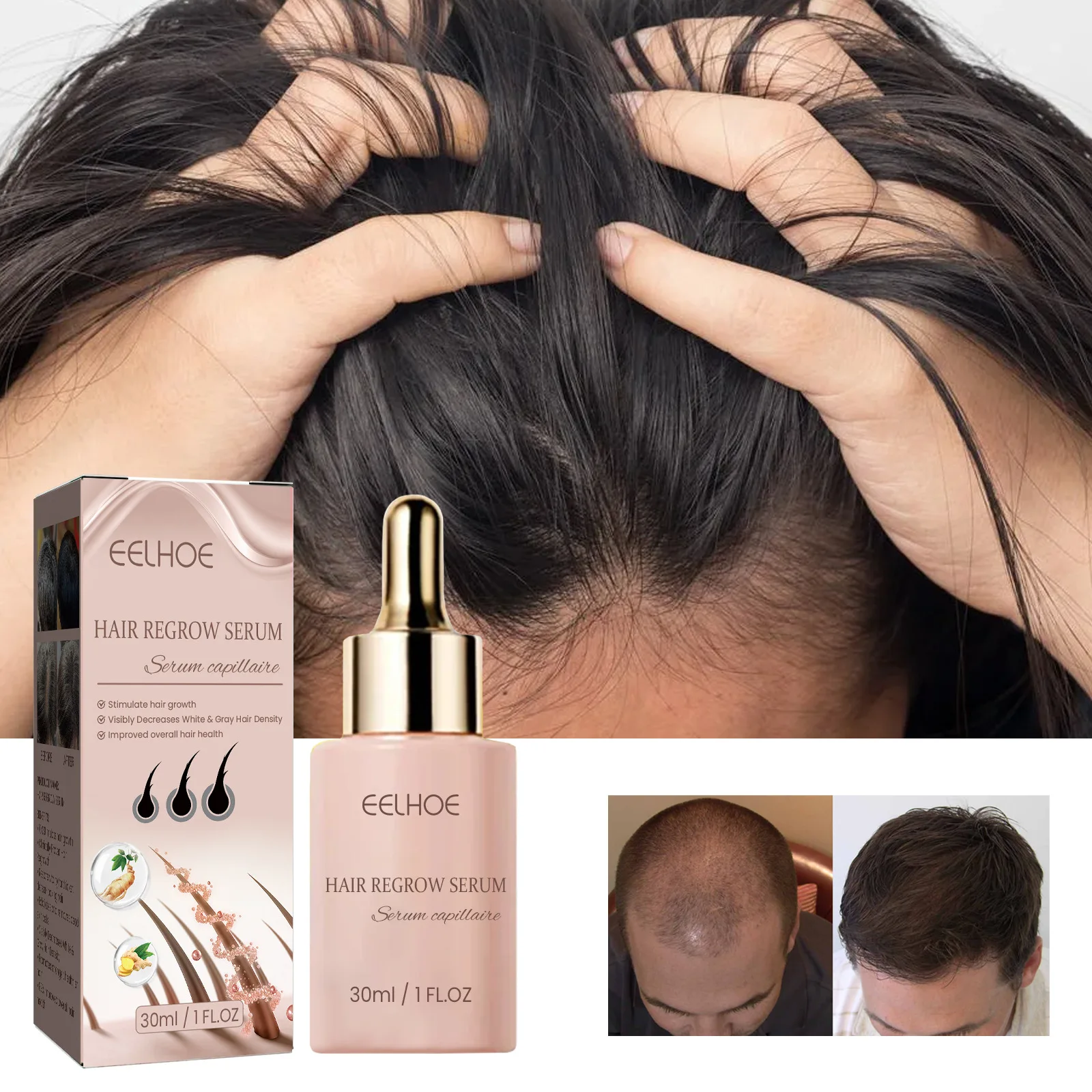 Huile essentielle anti-perte pour la croissance des cheveux