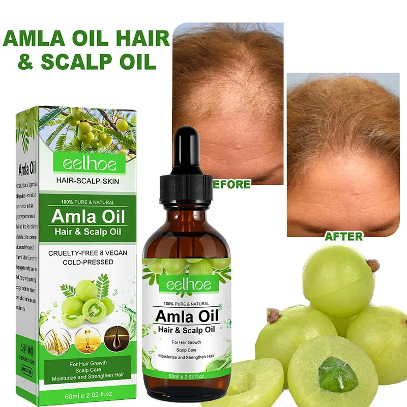 Amla Oil