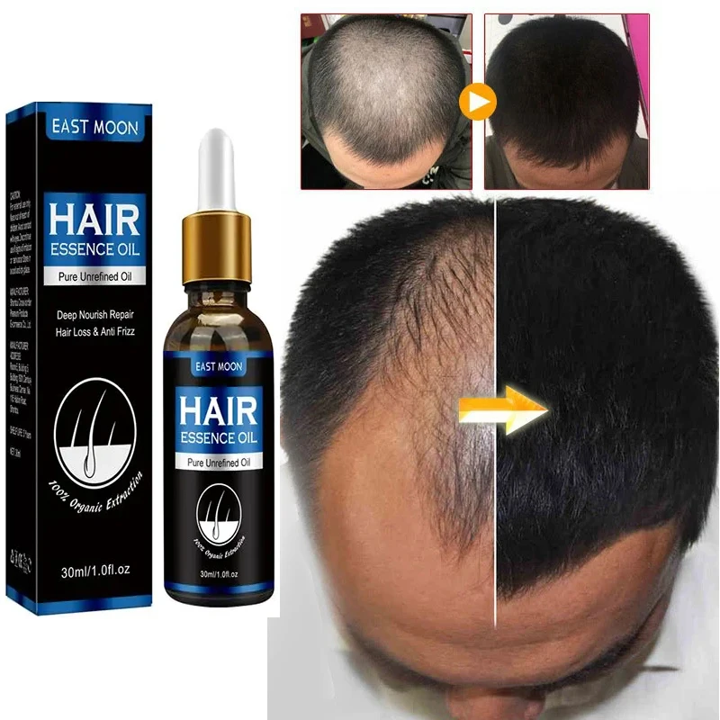 Produit Naturel Pour Faire Pousser Les Cheveux