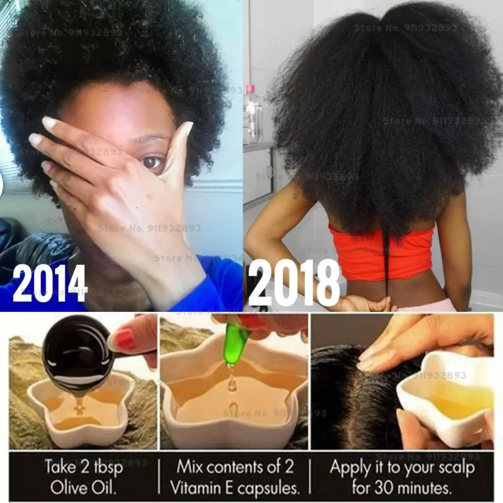Vitamine Cheveux Et Ongles